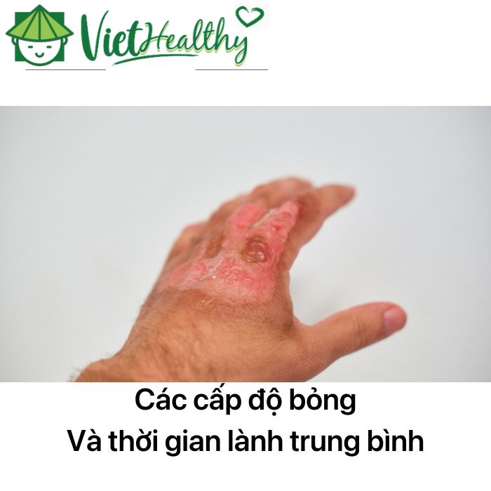 Các cấp độ và thời gian trung bình vết bỏng lành lại