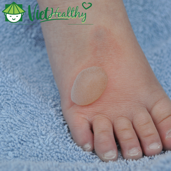 Sưng và nóng lên