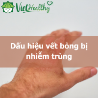 Dấu hiệu vết bỏng bị nhiễm trùng