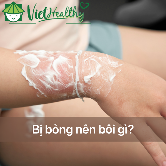 bị bỏng nên bôi gì