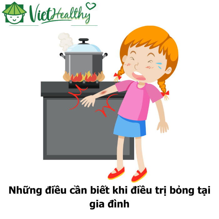 chữa bỏng tại nhà