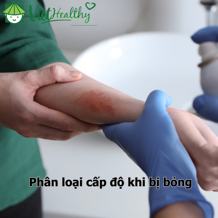 phân loại cấp độ bỏng